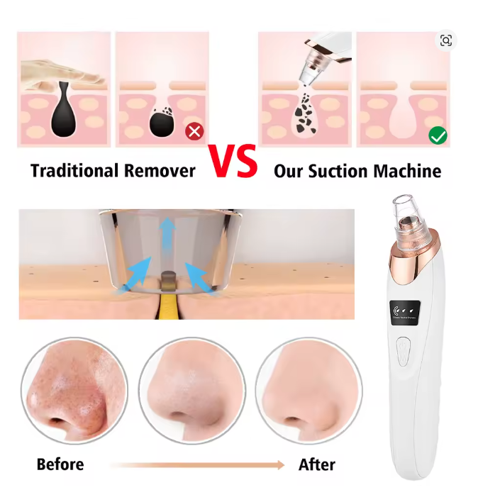 Extractor de impurezas y puntos negros