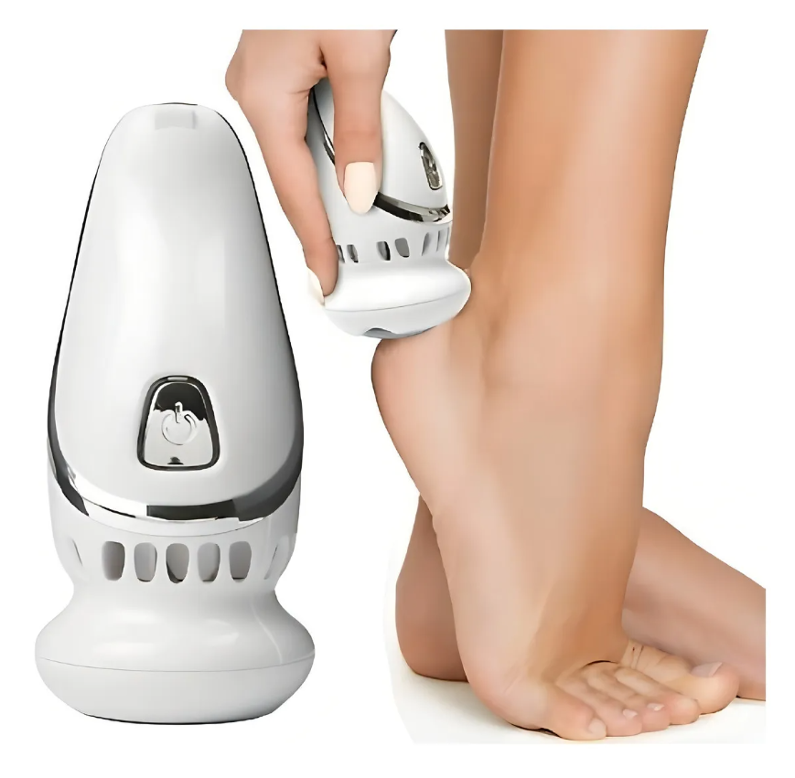 Maquina Elimina Callos al Instante